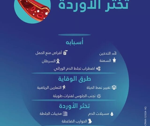 أبرزها السرطان.. “فهد الطبية” توضح أسباب “تخثر الأوردة” وطرق الوقاية