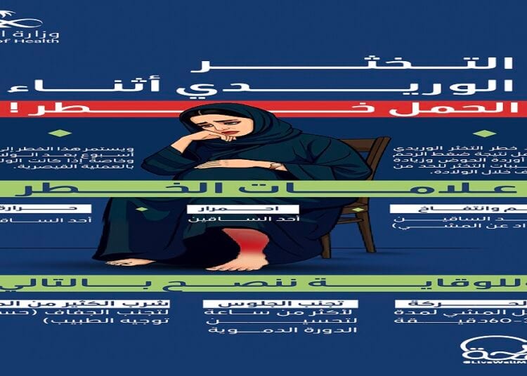 للمرأة الحامل.. الجلوس لساعات طويلة دون حركة يسبب التخثر الوريدي
