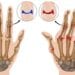 مؤتمر طب المستجدات في علاج أمراض الروماتيزم ينطلق غدًا بجدة