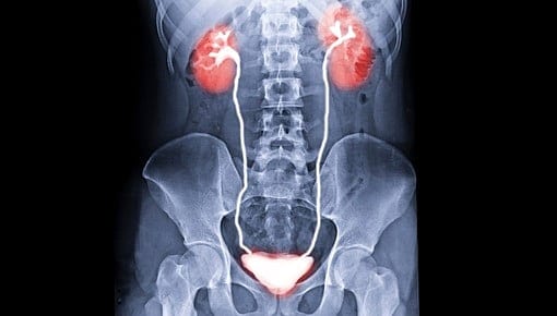 سابقة تاريخية في الطب.. نجاح عملية زرع مثانة بشرية لمريض
