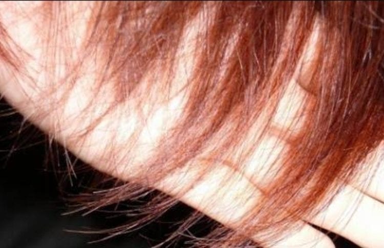 أشعة الشمس تهاجم شعركِ هذا الصيف.. ونصائح بسيطة تحميه وتمنحه تألقًا