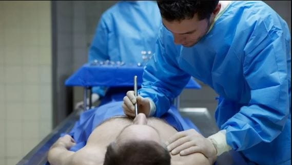رجل يعود إلى الحياة بعد 30 دقيقة من إعلان وفاته