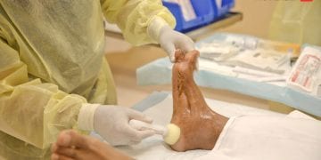 أمل جديد لآلاف المرضى.. مستشفى دكتور سليمان الحبيب يُطلق مركزاً لعلاج “القدم السكرية والجروح المزمنة”