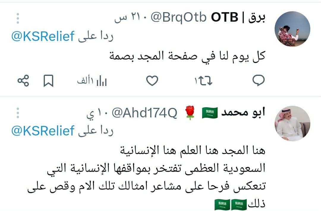 تفاصيل فصل التوائم الملتصق كليا وموريس في السعودية