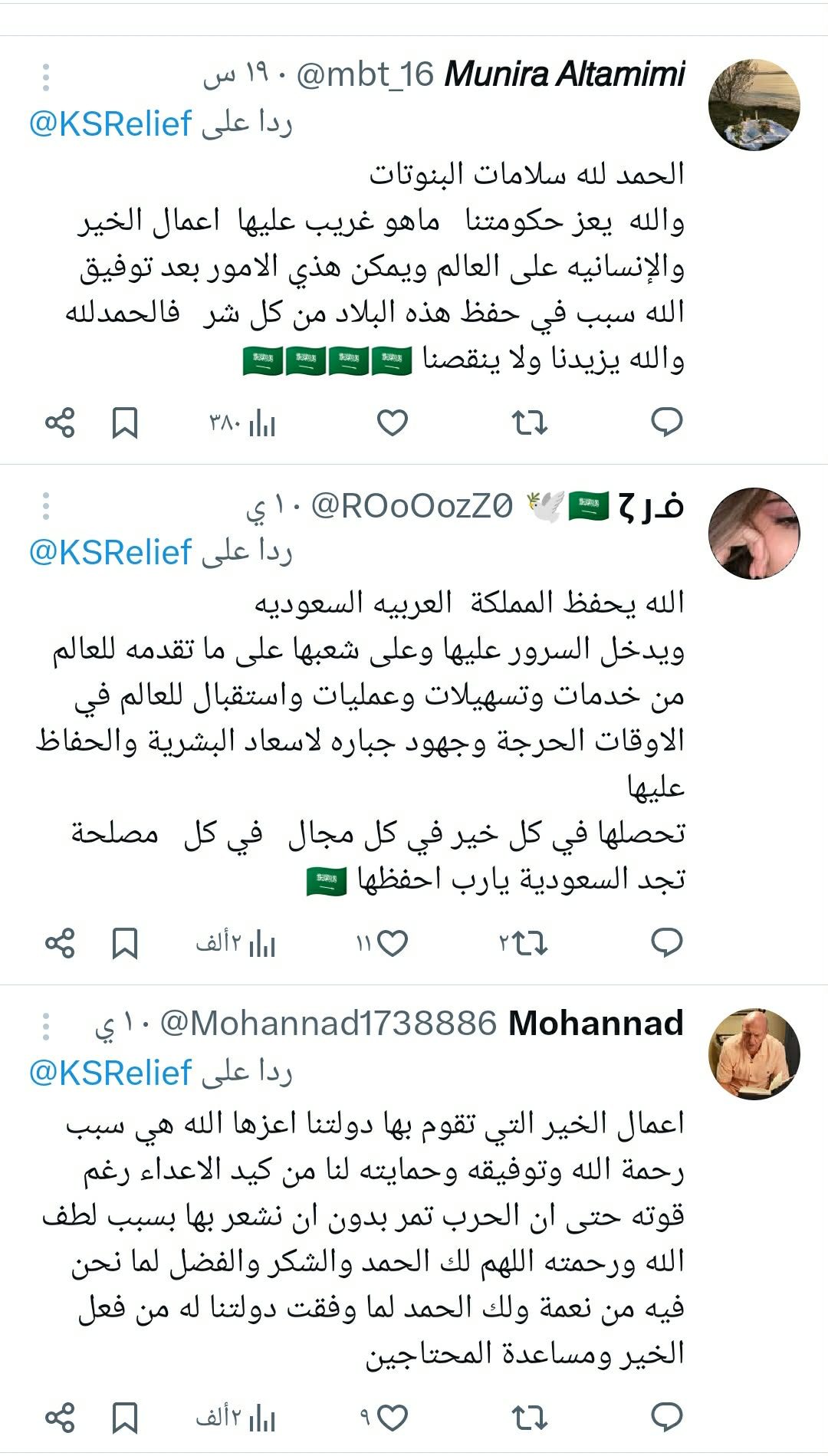 تفاصيل فصل التوائم الملتصق كليا وموريس