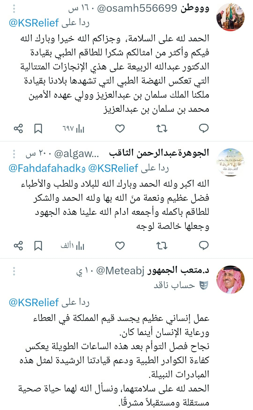 تفاصيل نجاح عملية فصل التوائم الملتصق كليا وموريس