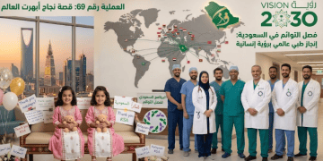 فصل التوائم في السعودية| سجل حافل بـ 69 عملية ناجحة أبهرت العالم