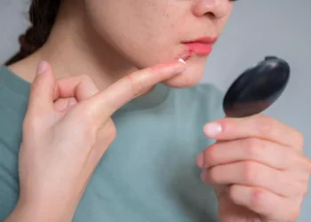 دراسة تكشف عن تأثير فيروس الهربس البسيط على الدماغ