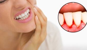 دراسة: أمراض اللثة يمكن أن تزيد من خطر الإصابة بأمراض القلب