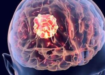 ابتكار تقنية جديدة يمكن ان تعالج سرطان المخ