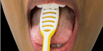 تبلغ من العمر 40 عاما.. هندية تبتلع فرشاة أسنان طولها 20 سم