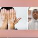 مختص: إصابة الطفل بتغيير في تصبغات الجلد يستوجب المتابعة بشكل سريع