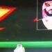 انعقاد الجلسة الأولى ضمن فعاليات المؤتمر الدولي للتوائم الملتصقة في الرياض