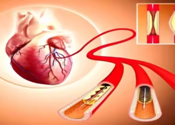 دعامات مرضى القلب بتقنية الطباعة ثلاثية الأبعاد في روسيا