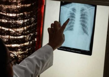 دراسة: تدخين سيجارة واحدة ​​ينقص عمر مدخنها حوالي 20 دقيقة في المتوسط