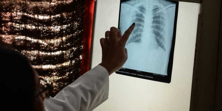 دراسة: تدخين سيجارة واحدة ​​ينقص عمر مدخنها حوالي 20 دقيقة في المتوسط