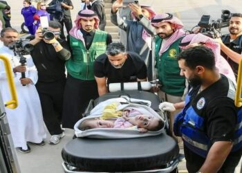 وصول التوأم الملتصق السوري "سيلين وإيلين" إلى الرياض