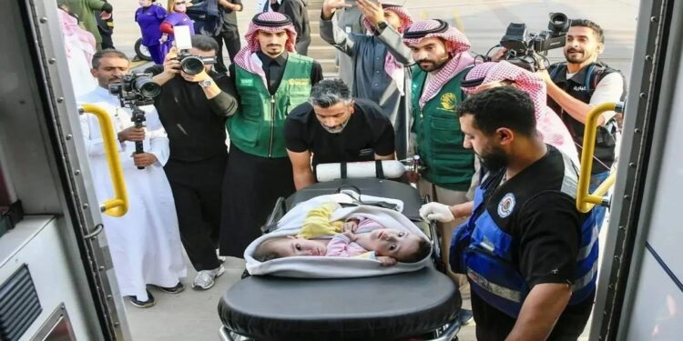 وصول التوأم الملتصق السوري "سيلين وإيلين" إلى الرياض