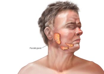 ينتقل من الرذاذ.. تعرف على أعراض “النكاف” ومضاعفاته وطرق الوقاية