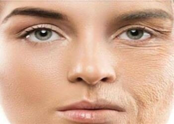 استشارية: التجاعيد تظهر بعد عمر 30 سنة..والتدخين من أسباب فقدان الجسم للكولاجين