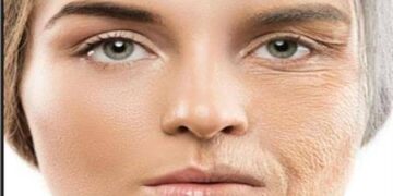 استشارية: التجاعيد تظهر بعد عمر 30 سنة..والتدخين من أسباب فقدان الجسم للكولاجين