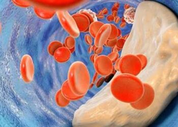 استشاري: مستوى الكوليسترول الضار يجب أن يكون أقل من 55 لدى مرضى جلطات القلب