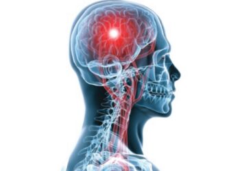 استشاري: 20% من جلطات الدماغ لدى كبار السن سببها رجفان القلب الأذيني