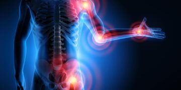 التدخين والتقدم في العمر.. تعرف على أبرز مسببات هشاشة العظام