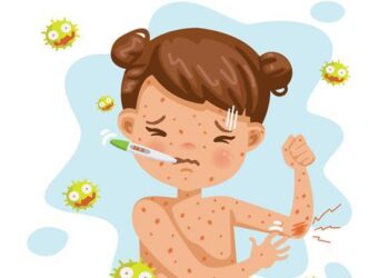 مرض الحصبة.. طرق انتقال العدوى والوقاية