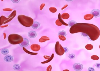 العلاج الجيني بتقنية كريسبر: أمل جديد لمرضى فقر الدم المنجلي وثلاسيميا بيتا