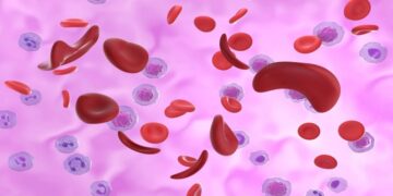 العلاج الجيني بتقنية كريسبر: أمل جديد لمرضى فقر الدم المنجلي وثلاسيميا بيتا