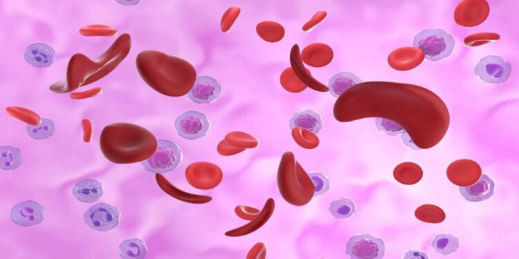 العلاج الجيني بتقنية كريسبر: أمل جديد لمرضى فقر الدم المنجلي وثلاسيميا بيتا