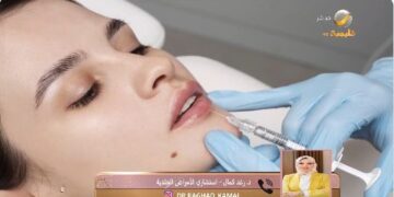 استشاري أمراض جلدية: لا غنى عن الفيلر والبوتكس مع التقدم في العمر (فيديو)