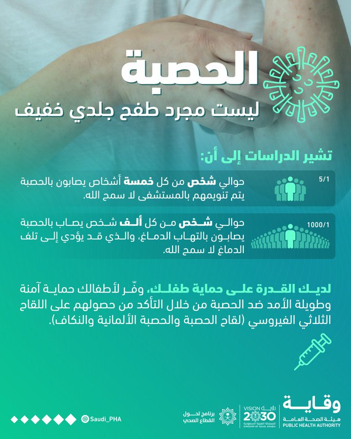تفاعل السعودية - مرض الحصبة.. طرق انتقال العدوى والوقاية