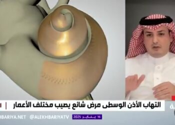 استشاري: اضطرابات الأذن الداخلية تؤثر على النظر بسبب ارتباطها بحركة العين