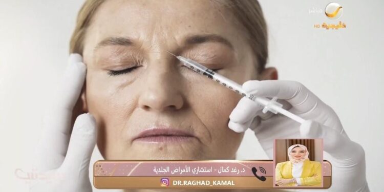 استشارية أمراض جلدية: “فيلر الكالسيوم” محفز للكولاجين ويمكن استخدامه في زيادة الحجم
