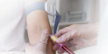 المجلس الصحي السعودي: فحص ما قبل السكري خطوة وقائية تنقذ حياتك