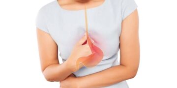 احذر.. الشوكولاتة والكافيين من أبرز مسببات الارتجاع المريئي