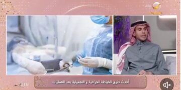 د. عمر فودة: الخياطة التجميلية تحتاج إلى تخدير موضعي مثل عمليات الأسنان
