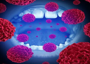 باحثون يكشفون كيف تتحول الخلايا السليمة إلى خلايا سرطانية في الفم بسرعة قياسية (إنفو جرافيك)