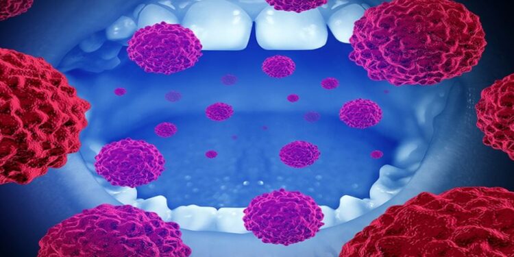 باحثون يكشفون كيف تتحول الخلايا السليمة إلى خلايا سرطانية في الفم بسرعة قياسية (إنفو جرافيك)