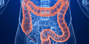 الخضيري :التوتر وسوء التغذية يفاقمان أعراض القولون العصبي