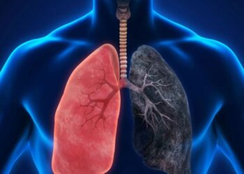 ارتفاع حالات سرطان الرئة بين غير المدخنين يثير قلق الباحثين (إنفو جرافيك)