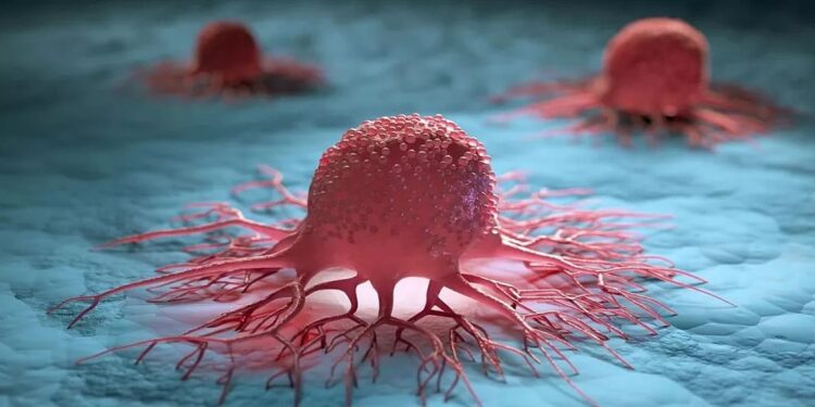 تجمع القصيم الصحي يحذر من 6 عوامل تزيد خطر الإصابة بالسرطان