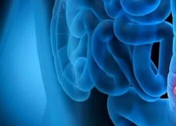 استشاري يوضح اسباب وعلاج قرحة القولون