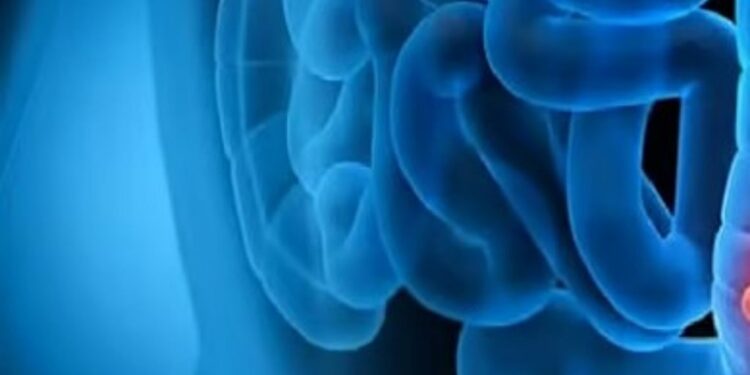 استشاري يوضح اسباب وعلاج قرحة القولون