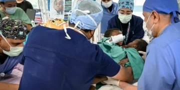 السعودية تنجح في فصل التوأم السيامي البوركيني “حوى وخديجة”