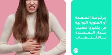 وكيل “الصحة”: جرثومة المعدة شائعة ولا تستدعي الفحص إلا بوجود أعراض