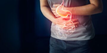 هل تعاني من القرحة الهضمية؟ إليك الحلول العملية لتخفيف الأعراض