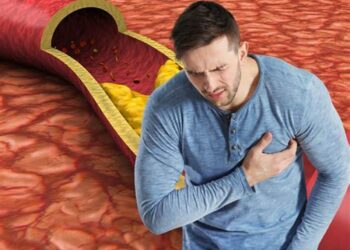 المجلس الصحي السعودي يطلق توصيات جديدة للوقاية من ارتفاع “الدهون الثلاثية”